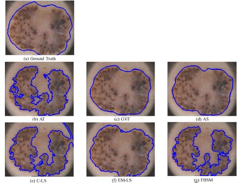 Automatic segmentation