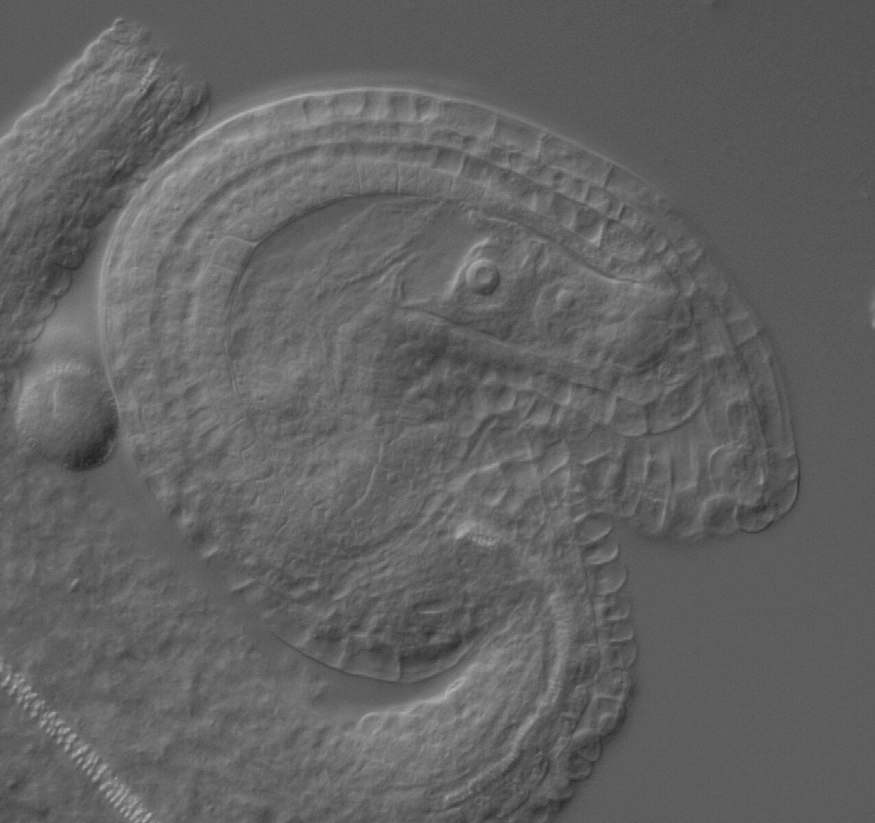 Arabidopsis ovule observed by DIC microscopy